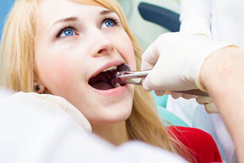 Nhổ răng hàm dưới có nguy hiểm không thưa bác sỹ?