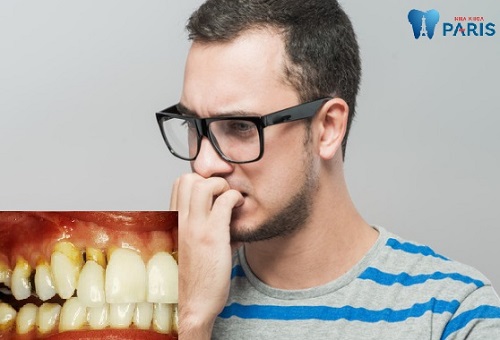 Chân răng bị mục đáng sợ ra sao Cách khắc phục triệt để nhất 2