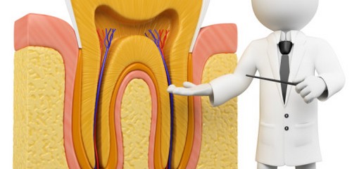 5 điều quan trọng cần biết về bệnh lý viêm tủy răng 1