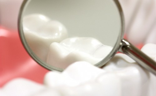 4 Nguyên nhân sâu răng và cách điều trị sâu răng hiệu quả VĨNH VIỄN 1