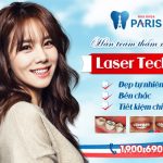 Hàn trám răng thẩm mỹ Laser Tech – tái tạo răng xấu hoàn hảo