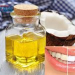 4 Cách làm trắng răng bằng dầu dừa đơn giản nhưng hiệu quả