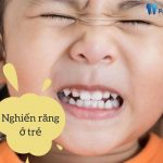 Bệnh nghiến răng ở trẻ em có chữa được không?