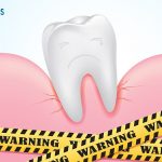 Bác sỹ tư vấn: Cứu nguy răng cấm bị lung lay trước TẾT