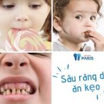 Lý do ăn kẹo sâu răng ở trẻ và cách phòng ngừa hiệu quả
